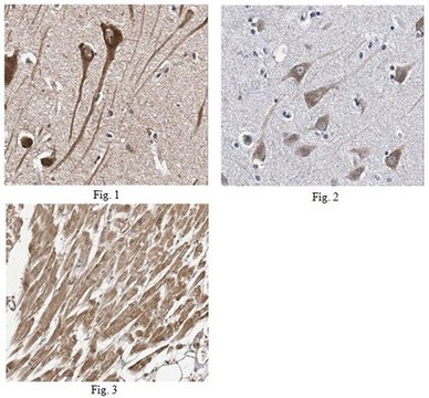 Anti-PTGDS Antibody from rabbit