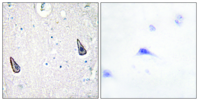 Anti-ADCY5 antibody produced in rabbit affinity isolated antibody