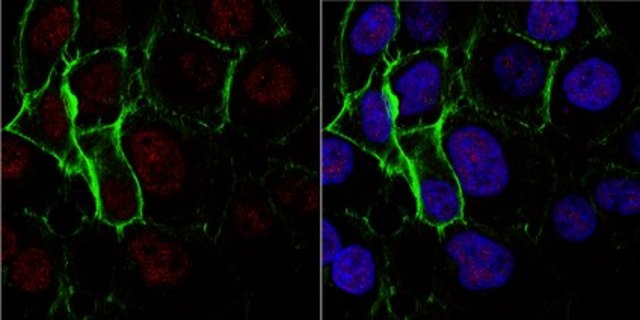 Anti-Nibrin/Nbs1 Antibody, clone EE15 (Ascites Free) clone EE15, from mouse