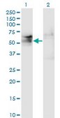 Monoclonal Anti-TSPYL1, (N-terminal) antibody produced in mouse clone 4F11, purified immunoglobulin, buffered aqueous solution