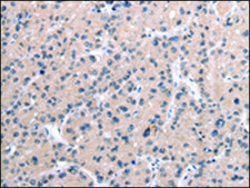 Anti-MORC2 affinity isolated antibody