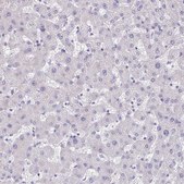 Anti-RNFT2 antibody produced in rabbit Prestige Antibodies® Powered by Atlas Antibodies, affinity isolated antibody, buffered aqueous glycerol solution