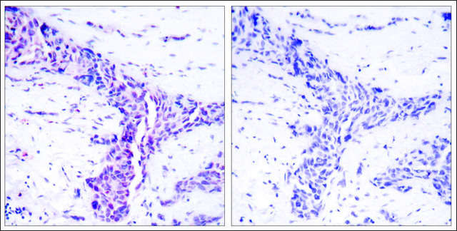 Anti-ATF2 (Ab-73 or 55) antibody produced in rabbit affinity isolated antibody