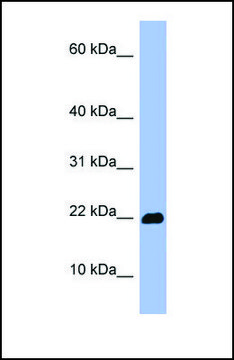 Anti-OMP antibody produced in rabbit affinity isolated antibody