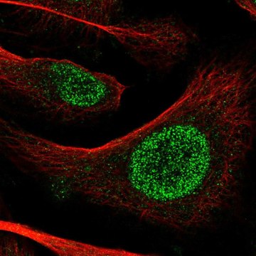 Anti-POT1 antibody produced in rabbit Prestige Antibodies&#174; Powered by Atlas Antibodies, affinity isolated antibody