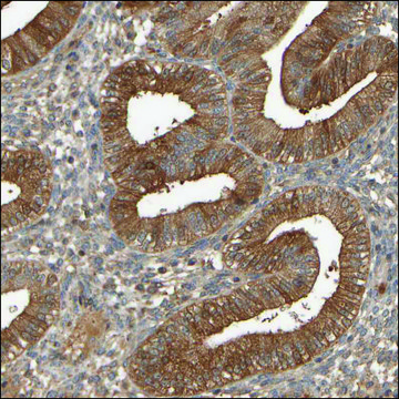 Anti-SPHK1 antibody produced in rabbit Prestige Antibodies&#174; Powered by Atlas Antibodies, affinity isolated antibody, buffered aqueous glycerol solution