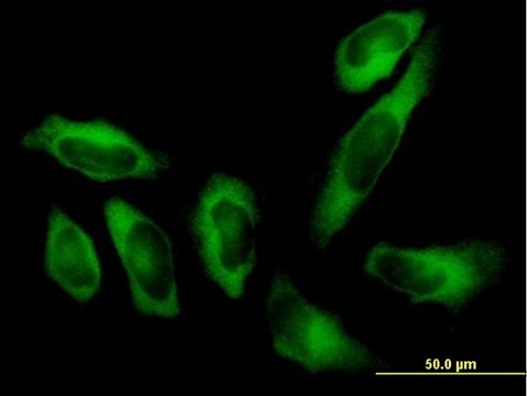 Anti-AARS antibody produced in mouse purified immunoglobulin, buffered aqueous solution