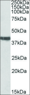 Anti-TNNT2 (C-terminal) antibody produced in goat affinity isolated antibody, buffered aqueous solution