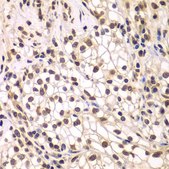 Anti-SMARCC1 antibody produced in rabbit