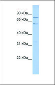 Anti-PRDM5 (ab2) antibody produced in rabbit affinity isolated antibody