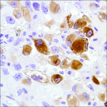 Anti-Tenascin X antibody, Rabbit monoclonal clone SP230, recombinant, expressed in proprietary host, affinity isolated antibody