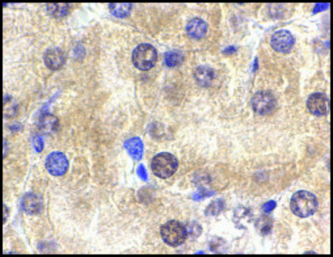 Anti-ST2 antibody produced in rabbit affinity isolated antibody, buffered aqueous solution