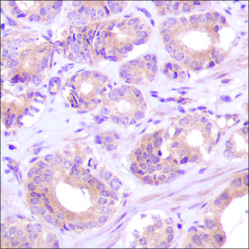 Anti-PTEN antibody, Rabbit monoclonal clone SP170, recombinant, expressed in proprietary host, affinity isolated antibody