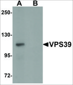 抗 VPS39 兔抗 affinity isolated antibody