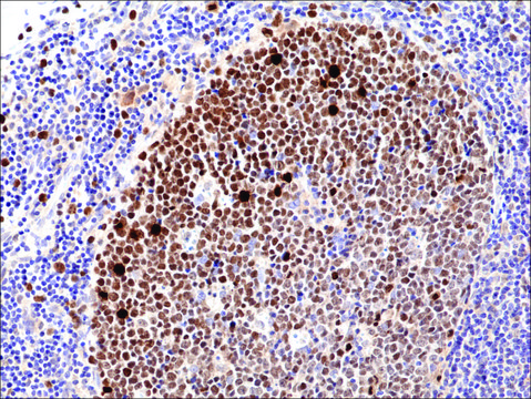 抗-KI67抗体，兔单克隆 recombinant, expressed in HEK 293 cells, clone RM360, purified immunoglobulin