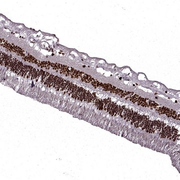 Anti-RB1 antibody produced in rabbit Prestige Antibodies&#174; Powered by Atlas Antibodies, affinity isolated antibody, buffered aqueous glycerol solution