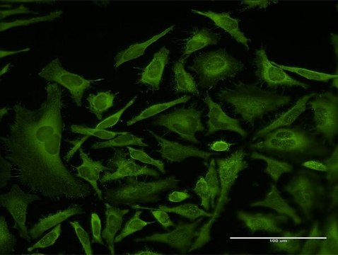 Monoclonal Anti-CAP1 antibody produced in mouse clone 4A9, purified immunoglobulin, buffered aqueous solution