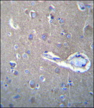 ANTI-SEC62 (N-TERM) antibody produced in rabbit IgG fraction of antiserum, buffered aqueous solution