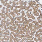 Anti-ADHFE1 antibody produced in rabbit Prestige Antibodies® Powered by Atlas Antibodies, affinity isolated antibody, buffered aqueous glycerol solution