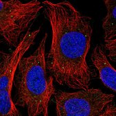 Anti-ABHD17A antibody produced in rabbit Prestige Antibodies® Powered by Atlas Antibodies, affinity isolated antibody, buffered aqueous glycerol solution