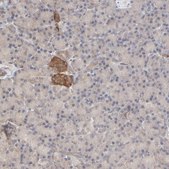 Anti-RAB5C antibody produced in rabbit Prestige Antibodies® Powered by Atlas Antibodies, affinity isolated antibody, buffered aqueous glycerol solution