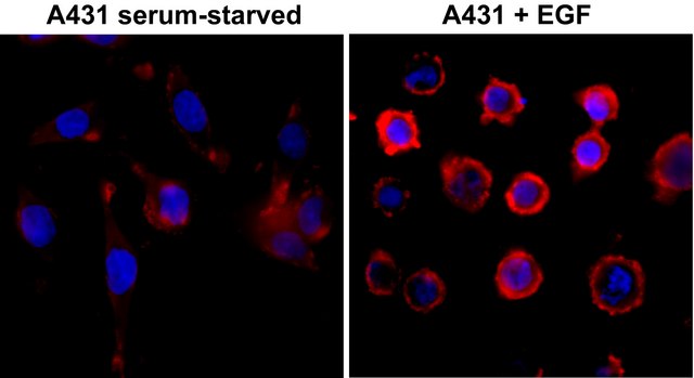 Anti-Phosphotyrosine antibody, Rabbit monoclonal recombinant, expressed in HEK 293 cells, clone RM111, purified immunoglobulin