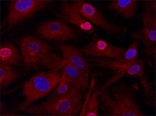 Anti-AQP5 (376-390) antibody produced in rabbit IgG fraction of antiserum, buffered aqueous solution