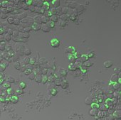 BioTracker™ Orange Zymosan Phagocytosis Live Cell Probe