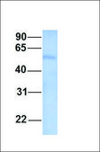 Anti-SEPT9 antibody produced in rabbit affinity isolated antibody