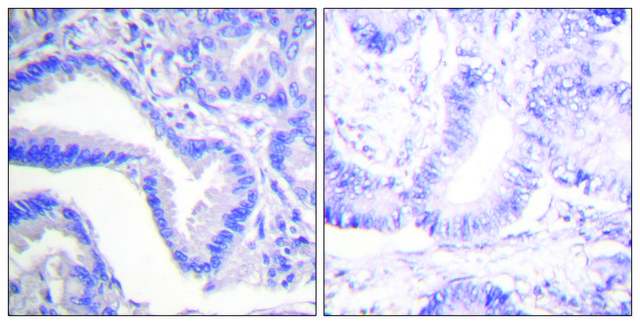 Anti-CASP7 (Cleaved-Asp198) antibody produced in rabbit affinity isolated antibody