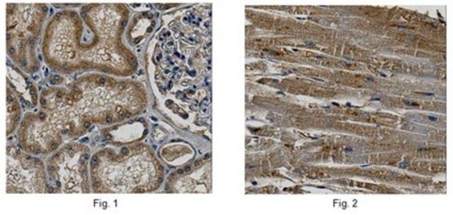 Anti-DDAH2 Antibody from rabbit, purified by affinity chromatography