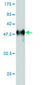 Monoclonal Anti-PKN1 antibody produced in mouse clone 1B10, purified immunoglobulin, buffered aqueous solution