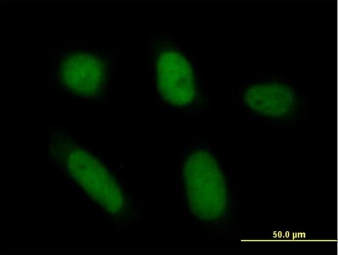 Anti-ANXA5 antibody produced in mouse purified immunoglobulin, buffered aqueous solution