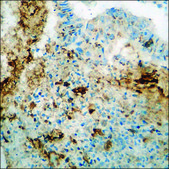 Anti-phospho-Cortactin (pTyr466) antibody produced in rabbit affinity isolated antibody