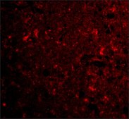 Anti-CTRP4 (ab2) antibody produced in rabbit affinity isolated antibody, buffered aqueous solution