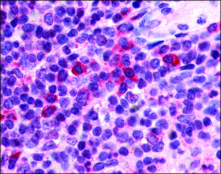 Anti-P2RY13 / P2Y13 antibody produced in rabbit affinity isolated antibody