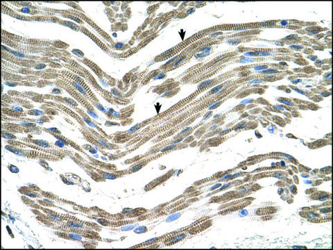 Anti-C1QB antibody produced in rabbit affinity isolated antibody