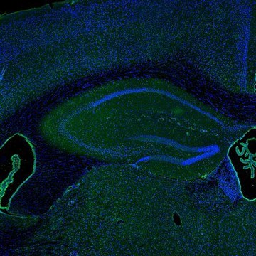 Anti-IER5 antibody produced in rabbit Prestige Antibodies&#174; Powered by Atlas Antibodies, affinity isolated antibody, buffered aqueous glycerol solution