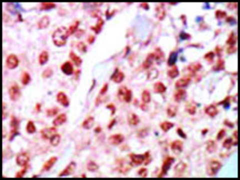 Anti-PRKAG1 (center) antibody produced in rabbit IgG fraction of antiserum, buffered aqueous solution