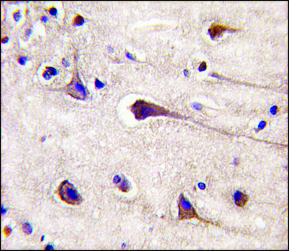 Anti-PIK3R2 (Y467) antibody produced in rabbit affinity isolated antibody, buffered aqueous solution