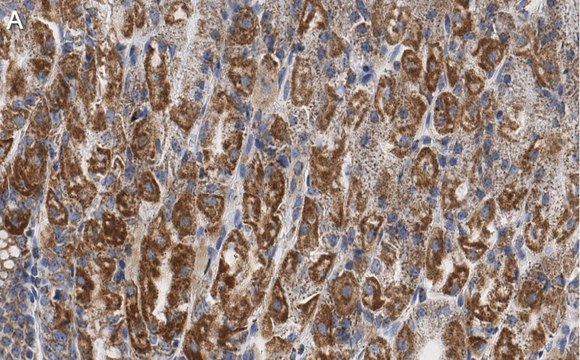 Anti-PNPT1 Antibody, clone 2D23 ZooMAb&#174; Rabbit Monoclonal recombinant, expressed in HEK 293 cells