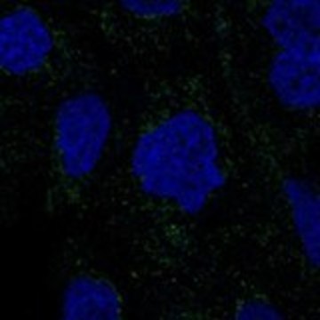 Anti-RSAD1 antibody produced in rabbit Prestige Antibodies&#174; Powered by Atlas Antibodies, affinity isolated antibody, buffered aqueous glycerol solution