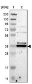Anti-TMBIM1 antibody produced in rabbit Prestige Antibodies® Powered by Atlas Antibodies, affinity isolated antibody, buffered aqueous glycerol solution