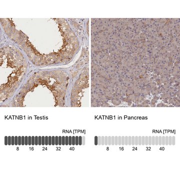 Anti-KATNB1 antibody produced in rabbit Prestige Antibodies&#174; Powered by Atlas Antibodies, affinity isolated antibody, buffered aqueous glycerol solution