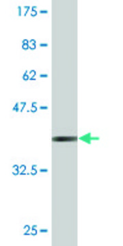 Monoclonal Anti-RECQL, (C-terminal) antibody produced in mouse clone 4D5, purified immunoglobulin, buffered aqueous solution