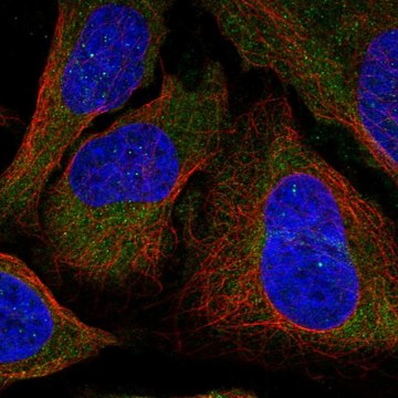 Anti-Dlc1 Antibody Produced In Rabbit Prestige Antibodies&#174; Powered by Atlas Antibodies, affinity isolated antibody, buffered aqueous glycerol solution