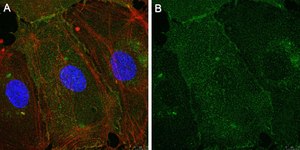 Anti-Integrin αVβ3 Antibody, clone LM609 ZooMAb® Mouse Monoclonal recombinant, expressed in HEK 293 cells