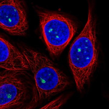 Anti-ZDHHC14 antibody produced in rabbit Prestige Antibodies&#174; Powered by Atlas Antibodies, affinity isolated antibody