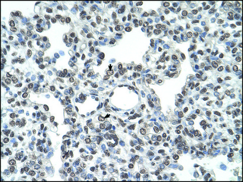 Anti-TMPRSS11D antibody produced in rabbit IgG fraction of antiserum