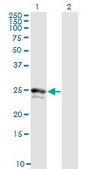 Monoclonal Anti-FGF21 antibody produced in mouse clone 1A8, purified immunoglobulin, buffered aqueous solution